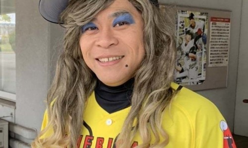 天津格林国际幼儿园学费-循环系统-第四节 先天性心脏病病人的护理网 - 人体结构几何体速写,乙肝患者可以吃茄子吗